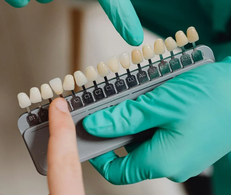 Dentiste présentant des gouttières de blanchiment sur mesure.