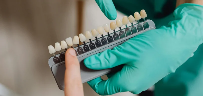 Dentiste présentant des gouttières de blanchiment sur mesure.